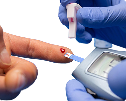 Shelcal 500mg Strip Of 15 Tablets